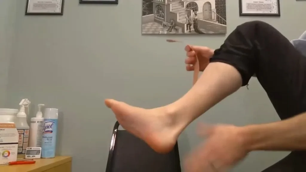 Applying a wrapped cold pack to a paintball bruise on the arm